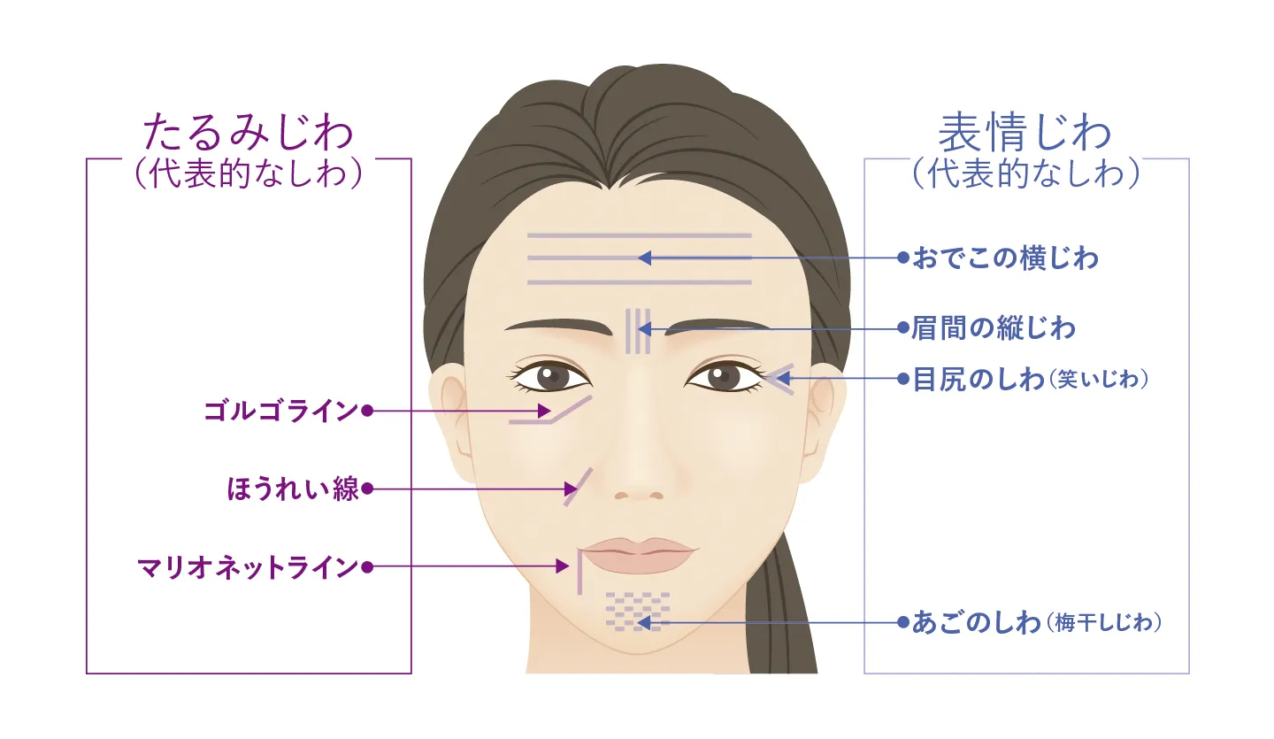 Image explaining types of wrinkles