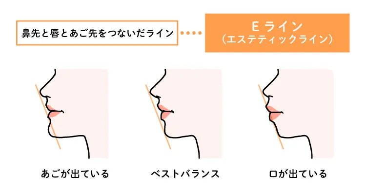 横顔美人の条件は？医師が教える、美しい横顔になるための方法｜美容 