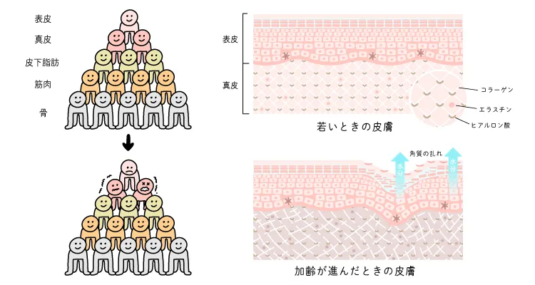 たるみの原因となる真皮層の変化