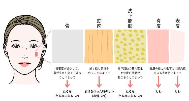 ほうれい線などのたるみじわは肌内部の形状が崩れることが原因