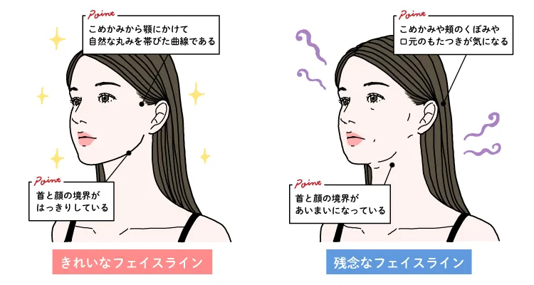 フェイスラインを引き締めるには？医師がすっきり整える方法を解説 