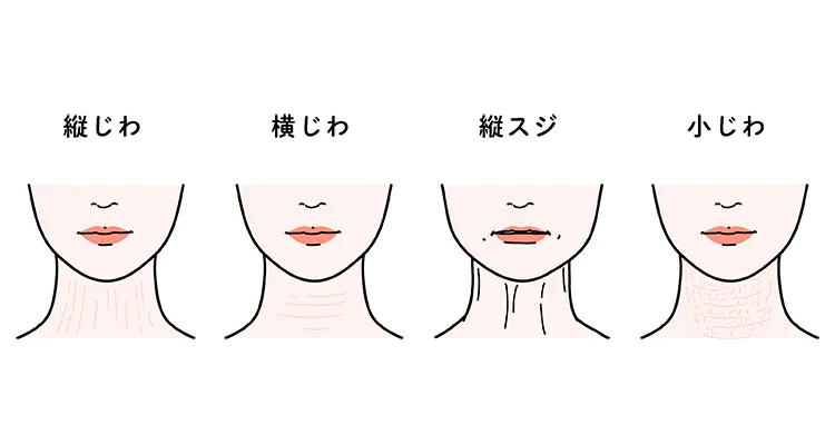 首のしわは縦じわ・横じわ・縦スジ・小じわの4種類