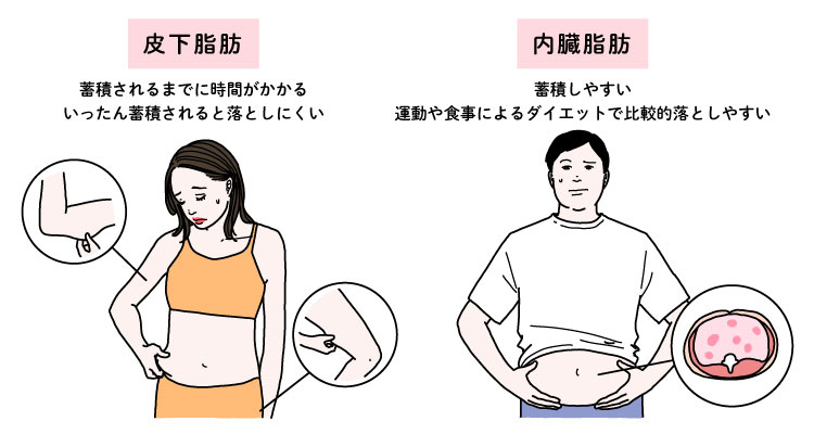 皮下脂肪と内臓脂肪の比較