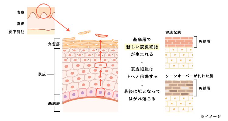 ターンオーバーのメカニズムとターンオーバーが乱れた肌のイメージ図
