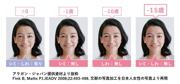 老け顔の特徴であるしわとシミによる見た目年齢の差