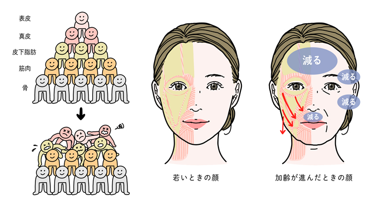 加齢による皮下脂肪の量の減少や移動のイメージ図