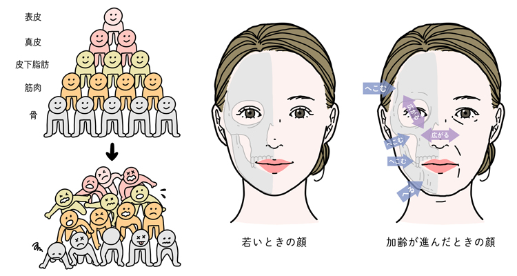 加齢による骨の変化のイメージ図