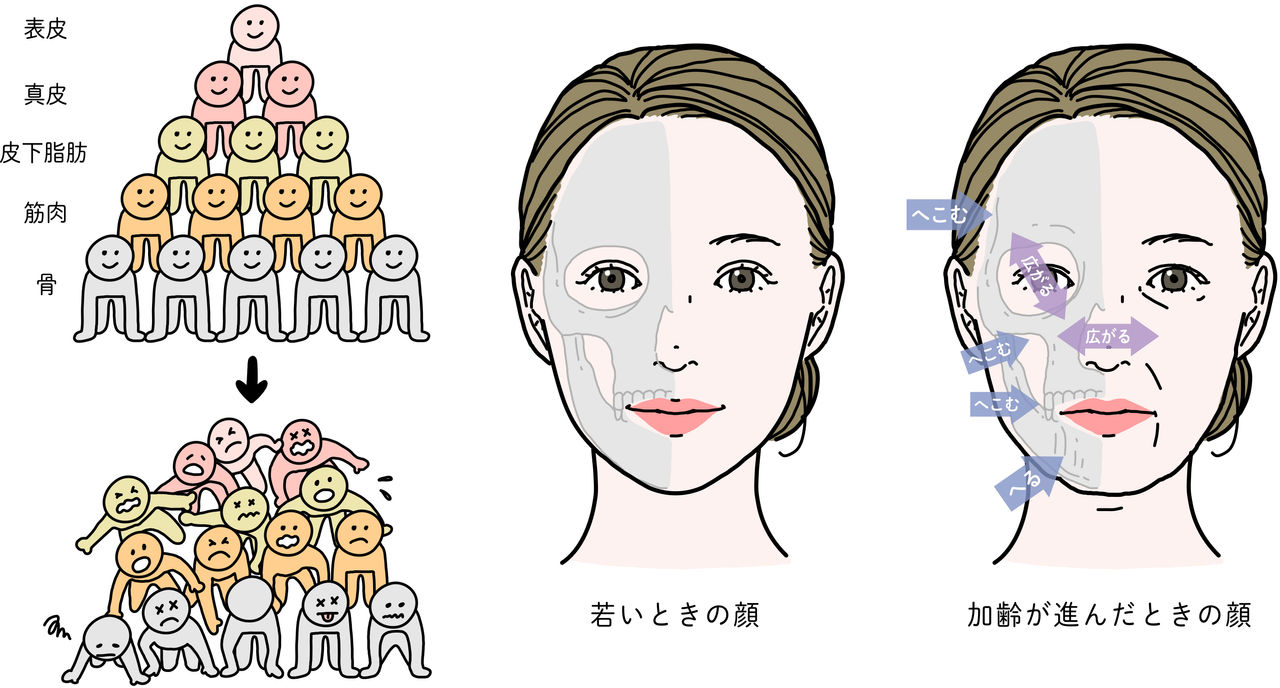 加齢による骨の変化
