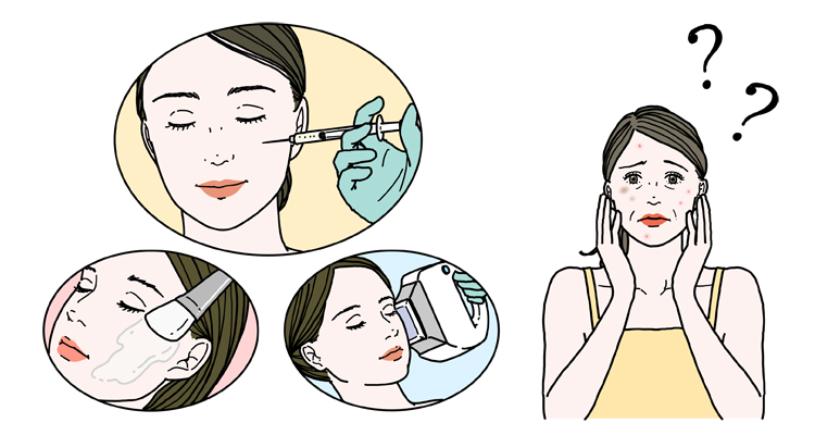 美容医療の治療法と肌悩みを抱える女性のイメージイラスト