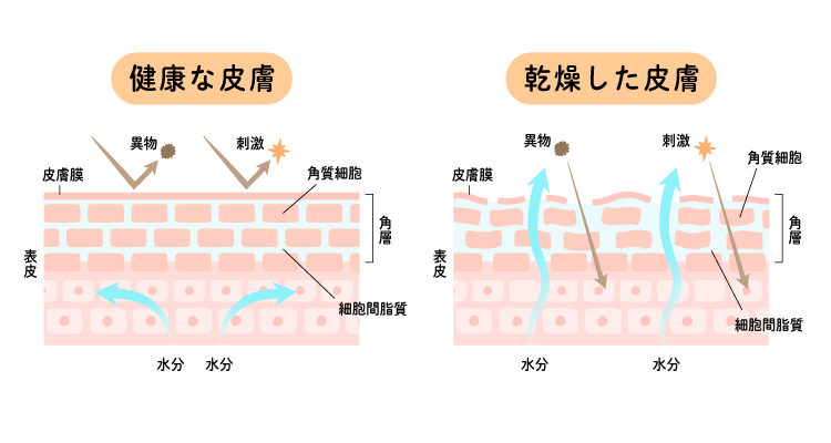 乾燥した皮膚は肌荒れが起こりやすい