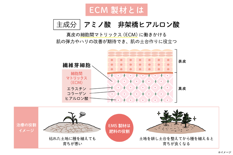 ECM製材の役割