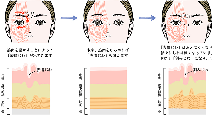 顔の筋肉を動かすと表情じわが生まれる