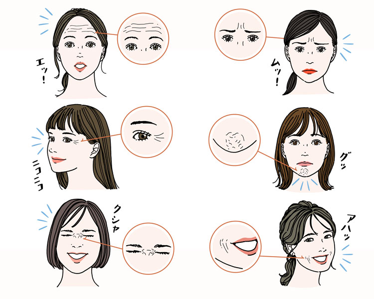 主な表情じわは6種類