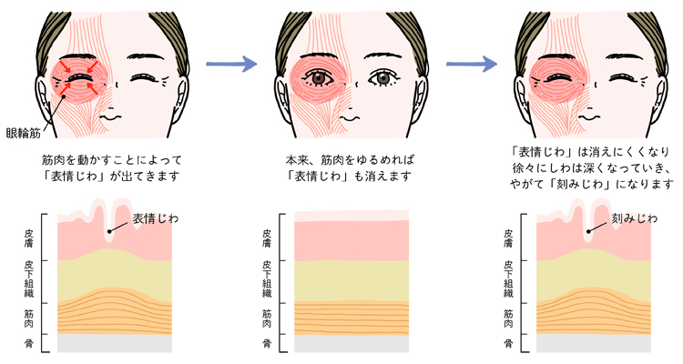 表情じわのメカニズム