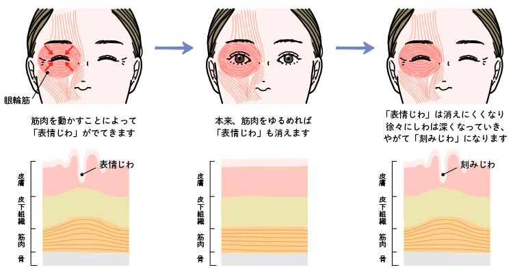 表情じわのメカニズム