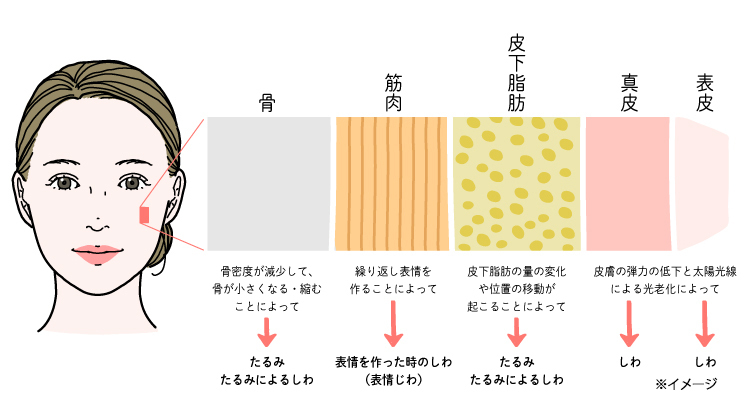 加齢による顔内部の変化で顔の形は崩れてしまう