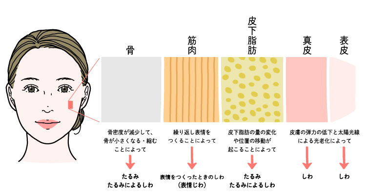 加齢による顔内部の変化で顔の形は崩れてしまう