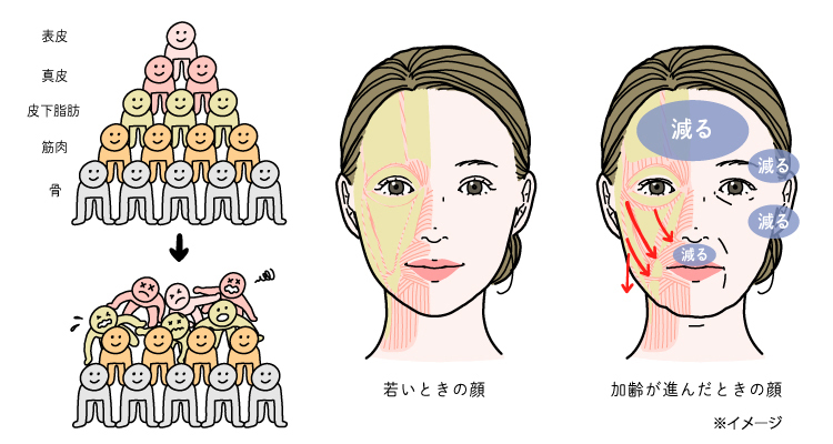 顔の形が崩れてしまう要因の一つ、加齢による皮下脂肪の変化