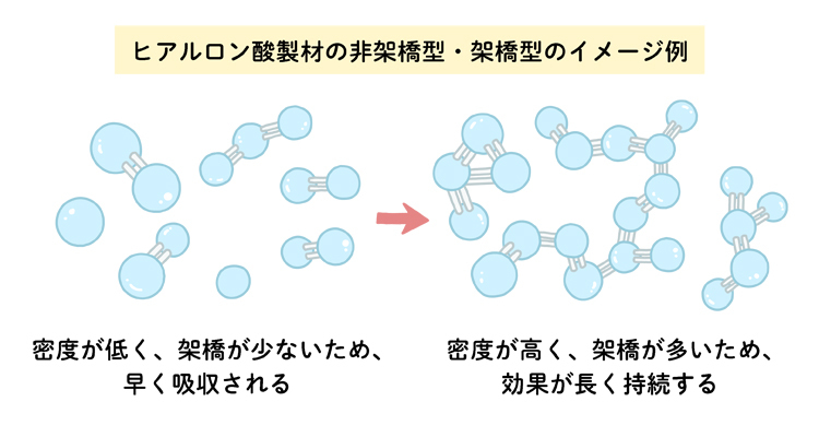 非架橋型と架橋型のヒアルロン酸製剤の構造と特徴を比較したイラスト