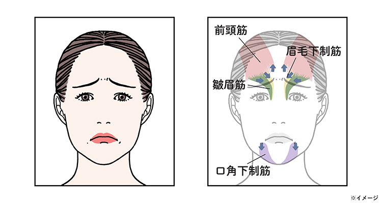 悲しみの表情で働く筋肉（前頭筋・眉毛下制筋・口角下制筋など）の図解
