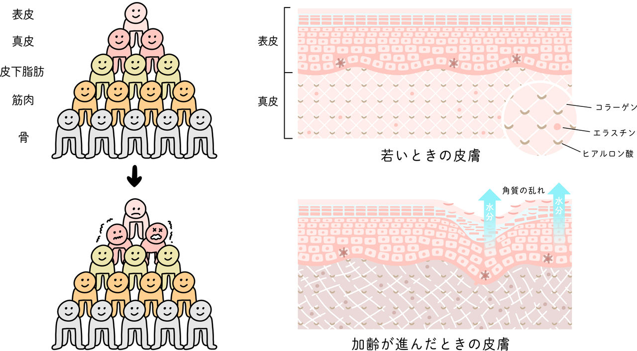 肌の弾力低下が大じわの原因に