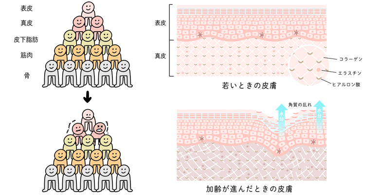 若いときの皮膚と加齢が進んだ時の皮膚のイメージ