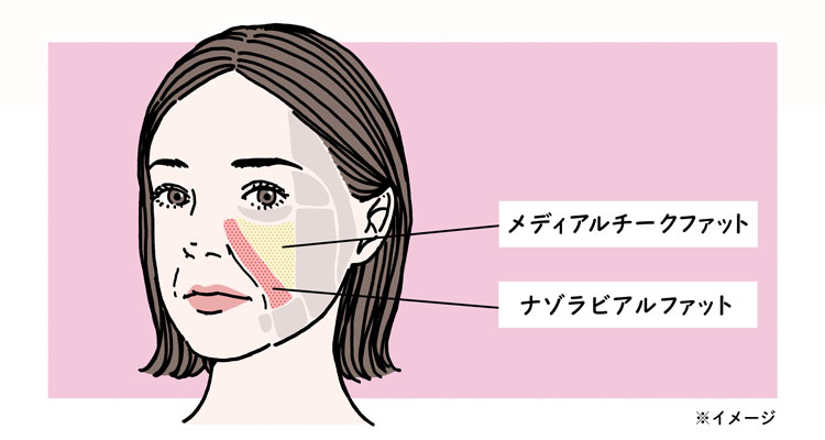 ほうれい線のできやすさに影響する顔の脂肪