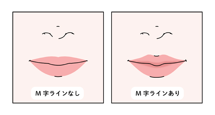 M字リップ