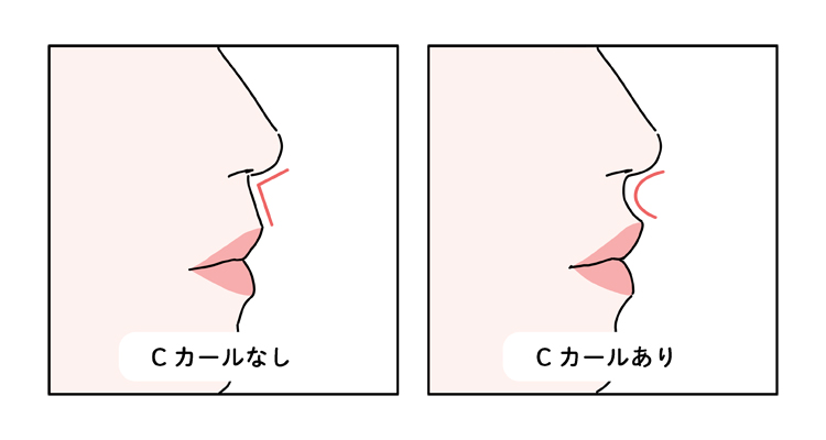 Cカールリップ