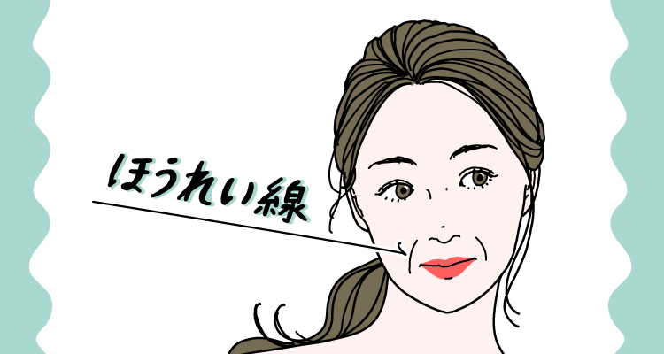顔の横から口角にかけてハの字に伸びる、ほうれい線が目立つ女性のイラスト