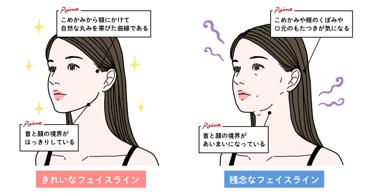 きれいなフェイスラインと、もたついたフェイスラインを比較したイラスト
