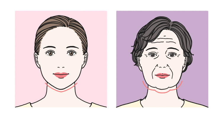 若い女性と年齢を重ねた女性のフェイスラインを比較したイラスト