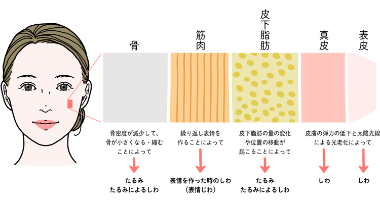 加齢による顔内部の変化はたるみが生じる原因の一つ