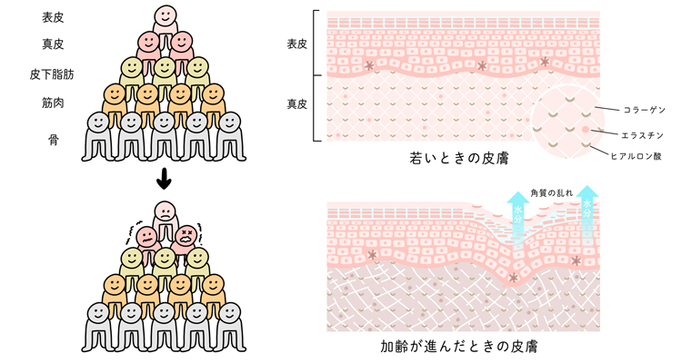 肌のハリや弾力性の低下によって皮膚のたるみが目立つ