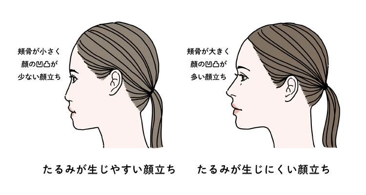 顔立ちによって顔のたるみやすさは異なる