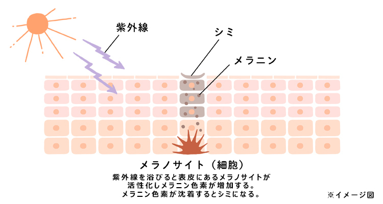シミができるメカニズム