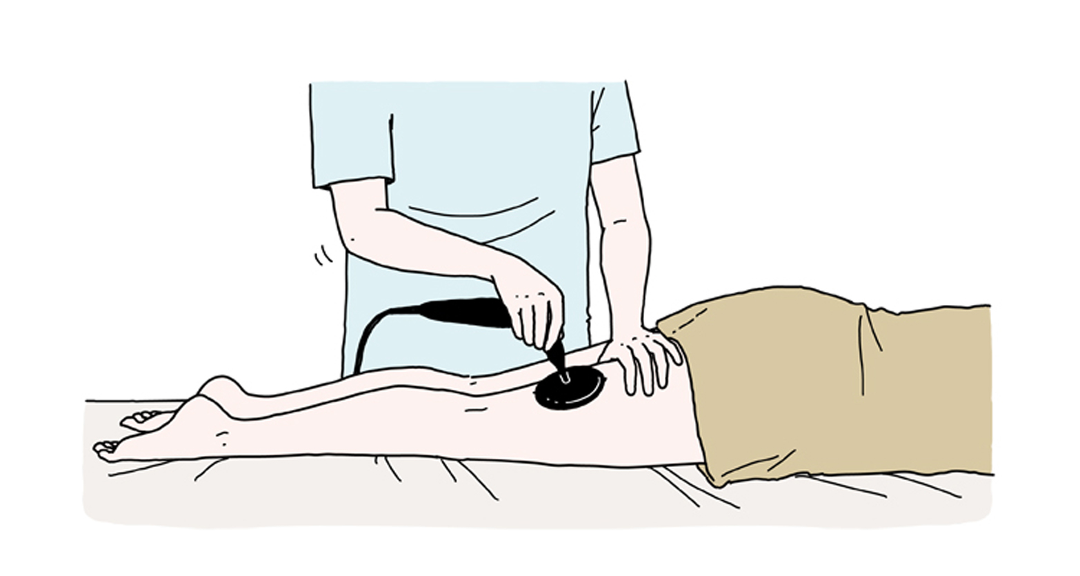 高周波（ラジオ波）による部分痩せ治療