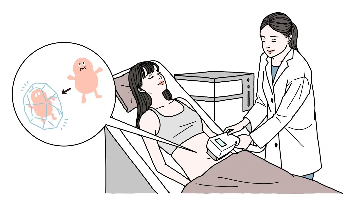 脂肪冷却治療を施術する医師と患者さんをイメージしたイラスト