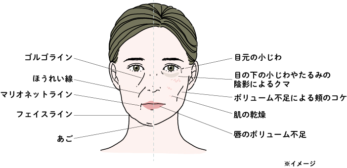 ヒアルロン酸注射でアプローチできるお悩み例