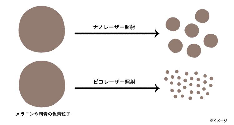 ナノレーザーとピコレーザーを照射したときの色素粒子のイメージ
