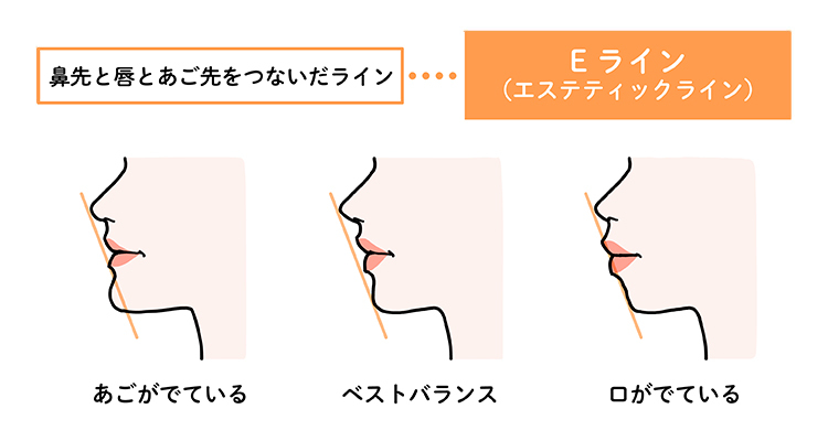鼻先と唇と顎先をつないだEラインが整っていると横顔のバランスが良いとされている