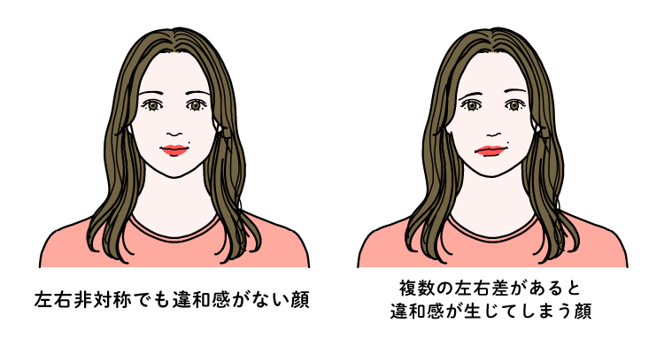 左右非対称で違和感が生じる顔の例
