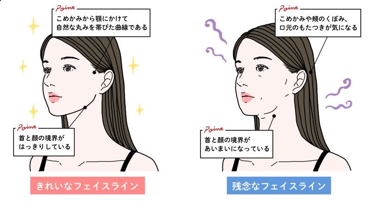 きれいなフェイスラインのポイントと残念なフェイスラインのポイント