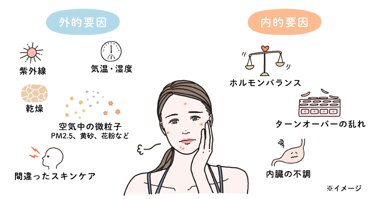 肌トラブルが起こるのは外的要因と内的要因の大きく2つに分けられる 