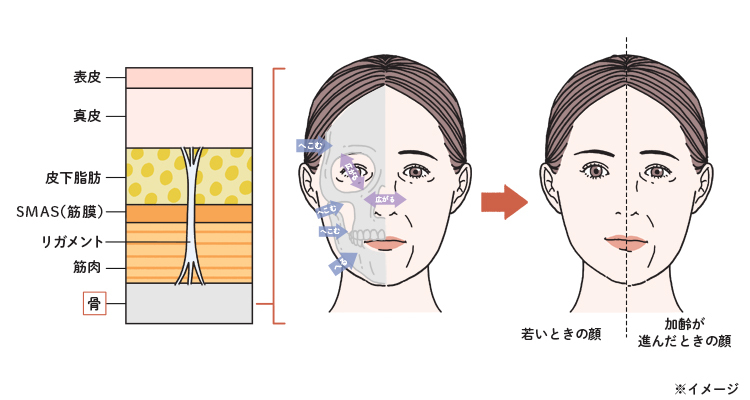 加齢によって骨が萎縮する