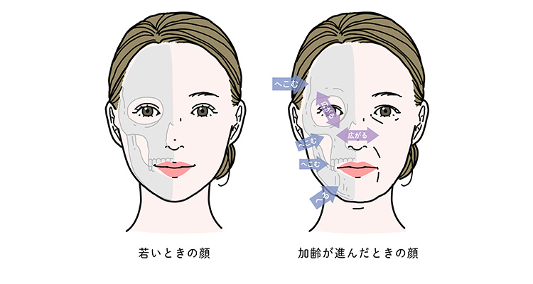 若いときの顔と加齢が進んだときの顔の比較イメージ