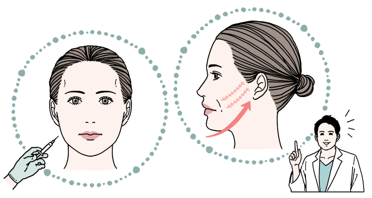 ヒアルロン酸注入治療と糸リフトのイメージ