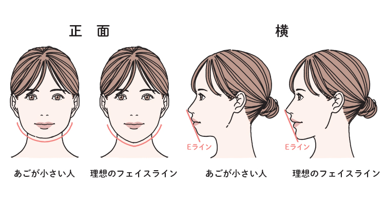 あごのバランスを整えると、小顔に見えるだけではなく、Eラインが整って、横顔もキレイに見える
